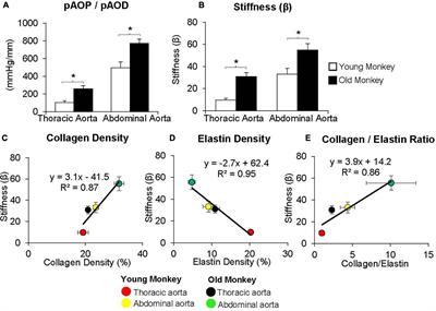 Vascular Stiffness in Aging and Disease